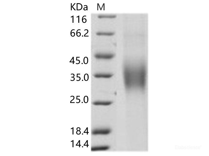 Recombinant HCV Envelope Glycoprotein E1 / HCV-E1 (subtype 1b, strain HC-J4) Protein (His Tag)
