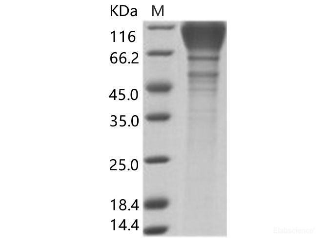 Recombinant HIV-1 (group M, subtype B, isolate BAL) gp120 Protein (His Tag)
