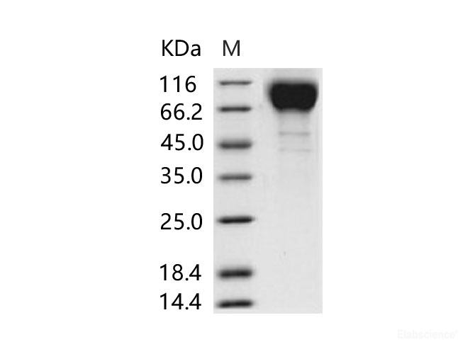 Recombinant HIV-1 gp120 Protein (group M, subtype CRF07_BC) (His Tag)