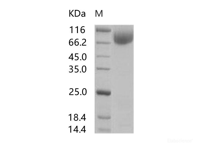 Recombinant HIV-1 gp140 Protein (group M, subtype A, strain 92UG037.1) (Fc Tag)