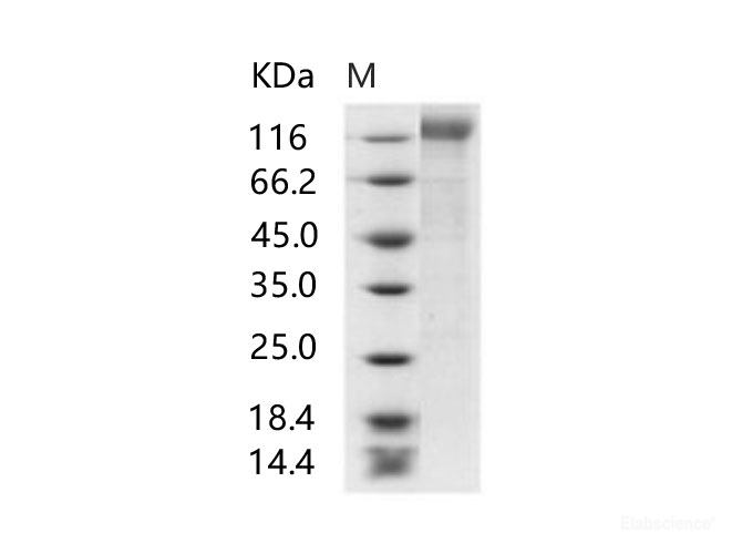 Recombinant HIV-1 gp140 Protein (group M, subtype CRF07_BC) (His Tag)