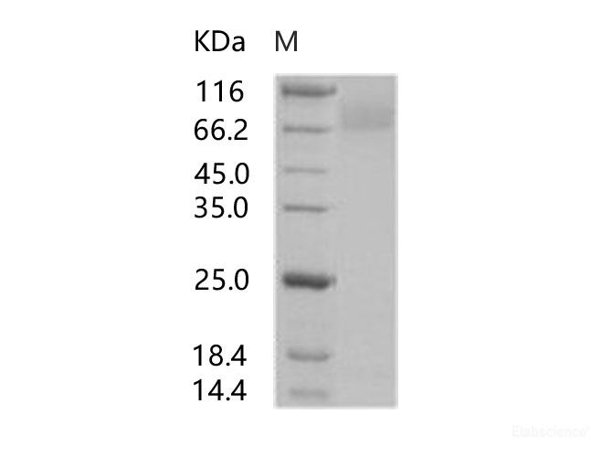 Recombinant HIV-1 gp140 Protein (group P, strain RBF168) (Fc Tag)
