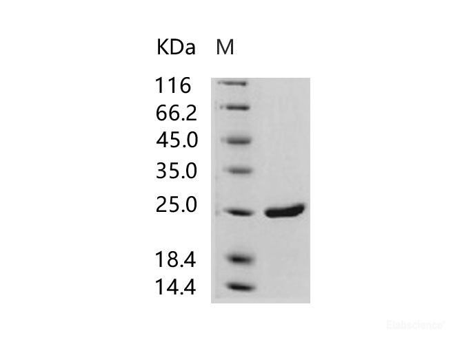 Recombinant HIV-1 p24 Protein (group M, subtype B, strain 92418) (His Tag)