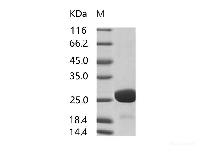 Recombinant HIV-1 p24 Protein (group M, subtype B, strain HXB2) (His Tag)