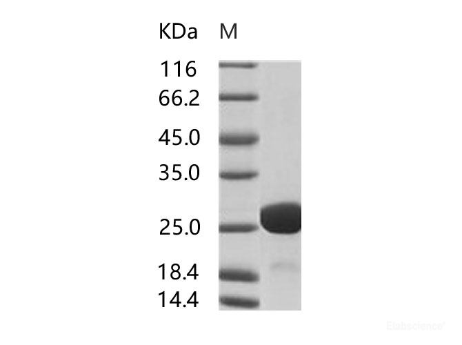 Recombinant HIV-1 p24 Protein (group M, subtype C, strain 92BR025) (His Tag)
