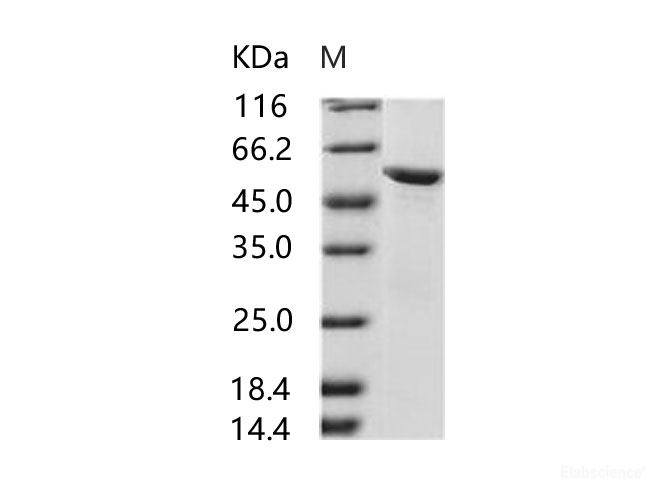 Recombinant HIV-2 gp36 Protein (subtype CRF01_AB, strain 07JP_NMC716_clone_01) (His & MBP Tag)