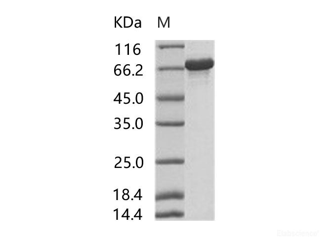 Recombinant HIV-p66 / RT-p66 (group M, subtype B (isolate HXB2) Gag-Pol polyprotein Protein (His Tag)