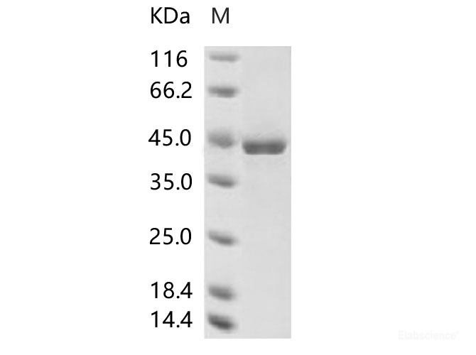 Recombinant Human coronavirus (HCoV-229E) Nucleoprotein / NP Protein (His Tag)