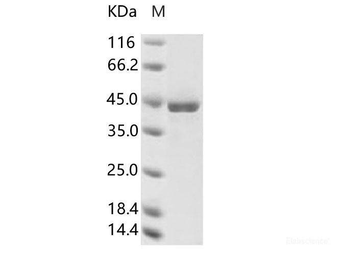 Recombinant Human coronavirus (HCoV-NL63) Nucleoprotein / NP Protein (His Tag)