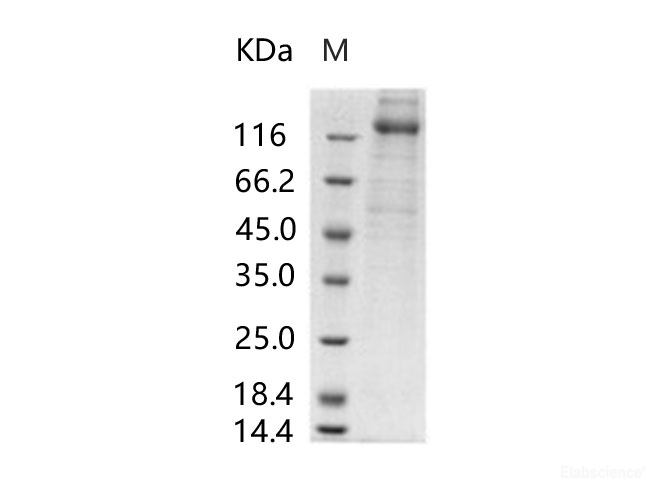 Recombinant Human cytomegalovirus (HCMV) Glycoprotein B / gB Protein (His Tag)