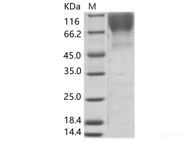 Recombinant HIV-1 (group M, subtype B, Isolate MN) gp120 Protein (His Tag)