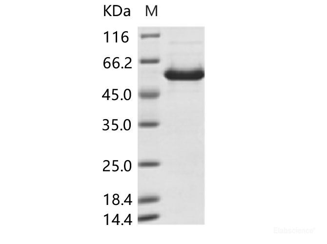 Recombinant Human mastadenovirus B (HAdV-B) encapsidation protein IVa2 Recombinant (His Tag)