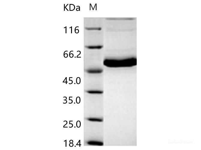 papilloma virus 33