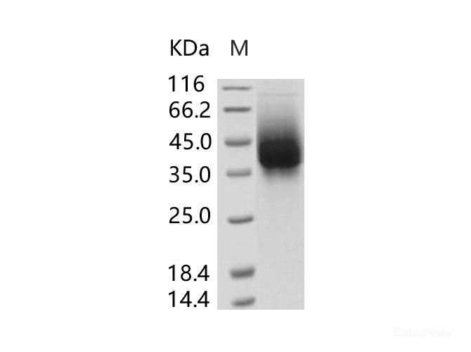 Recombinant RSV (A, rsb1734) glycoprotein G / RSV-G Protein (93% Homology) (His Tag)