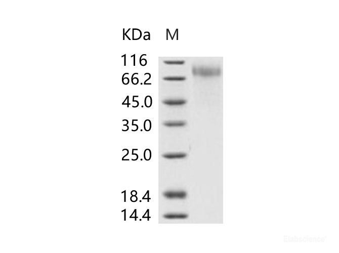 Recombinant RSV (A, rsb1734) glycoprotein G / RSV-G Protein (95% Homology) (His Tag)