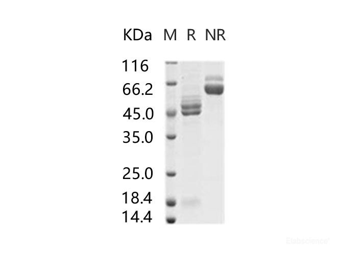 Recombinant RSV (A2) Fusion glycoprotein / RSV-F Protein (His Tag)