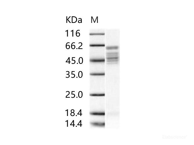 Recombinant RSV Fusion protein / RSV-F (Strain RSS-2) Protein (His Tag)