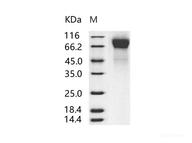 Recombinant Human RSV (B1) glycoprotein G / RSV-G Protein (His Tag)