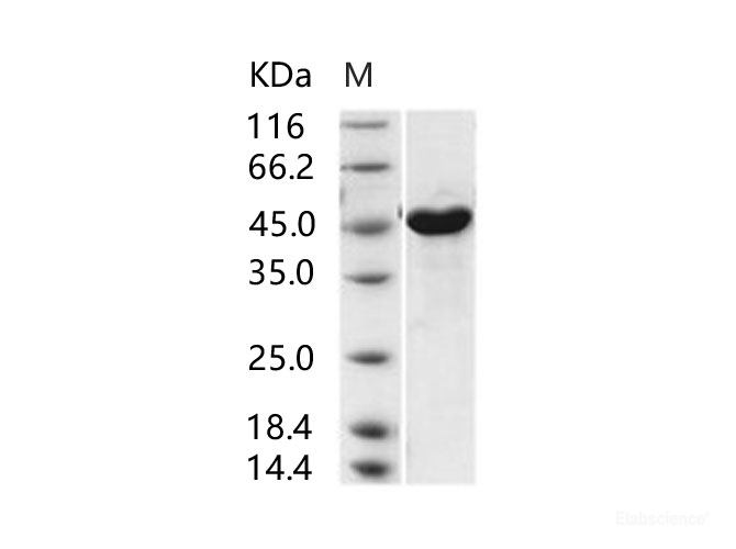 Recombinant MERS-CoV Nucleoprotein / NP protein (His Tag)