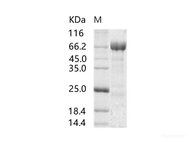 Recombinant MERS-CoV Spike Protein (S1+S2 ECD, aa 1-1297, His Tag)