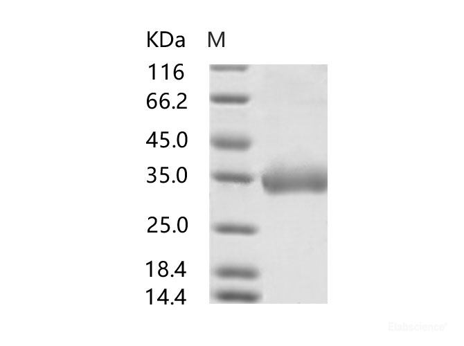 Recombinant MERS-CoV Spike/RBD Protein fragment (RBD, aa 367-606, His Tag), Biotinylated