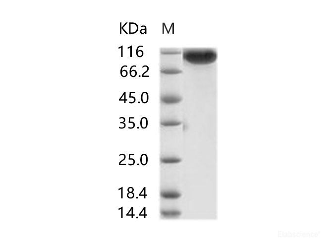 Recombinant MERS-CoV Spike/S1 Protein (S1 Subunit, aa 1-725, His Tag)