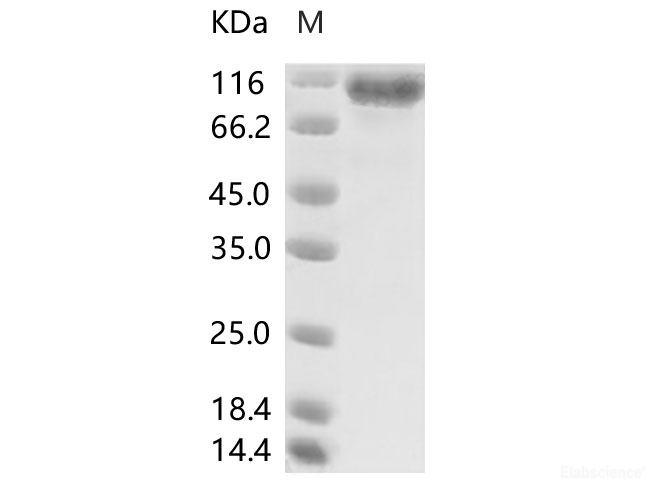 Recombinant MERS-CoV Spike/S1 Protein (S1 Subunit, aa 1-725, His Tag), HPLC-verified