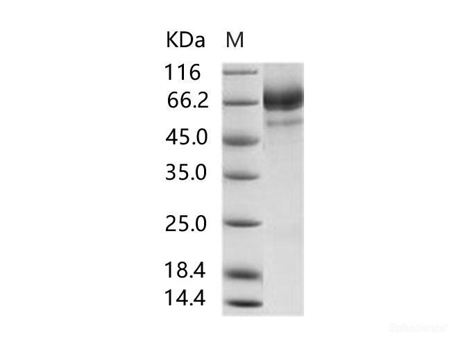 Recombinant MERS-CoV Spike/S2 Protein (S2 Subunit, aa 726-1296, His Tag)