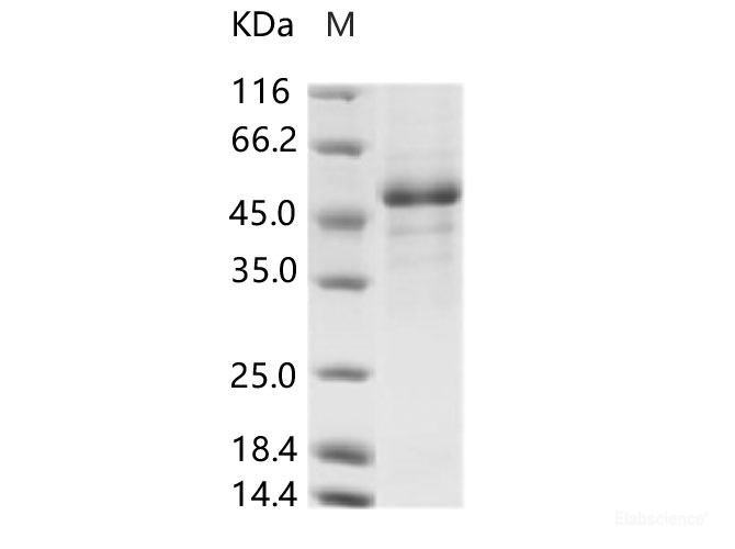 Recombinant Rift Valley fever virus (RVFV) (strain MP12) glycoprotein / G1 Protein (His Tag)