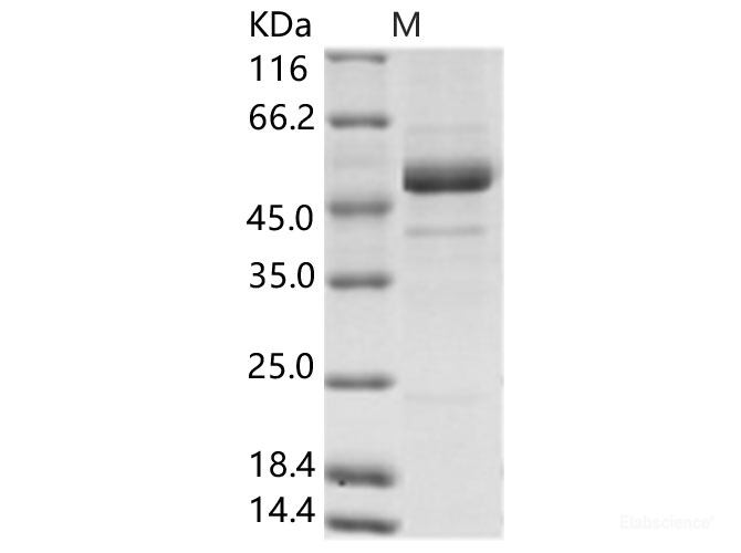 Recombinant Rift Valley fever virus (RVFV) (strain MP12) glycoprotein / G2 Protein (His Tag)