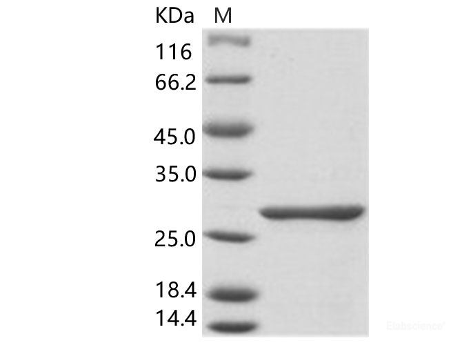 Recombinant Rift Valley fever virus (TAN/Dod-002/07) RVFV-L Protein (His Tag)