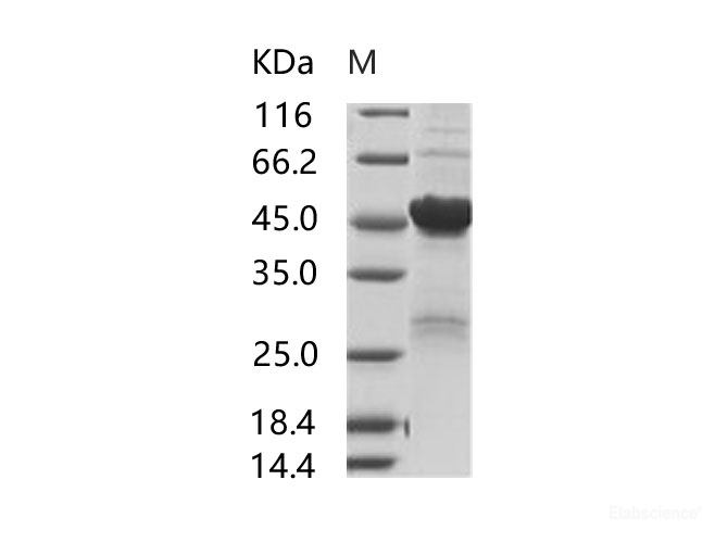 Recombinant SARS-CoV Nucleoprotein / NP Protein (His Tag)