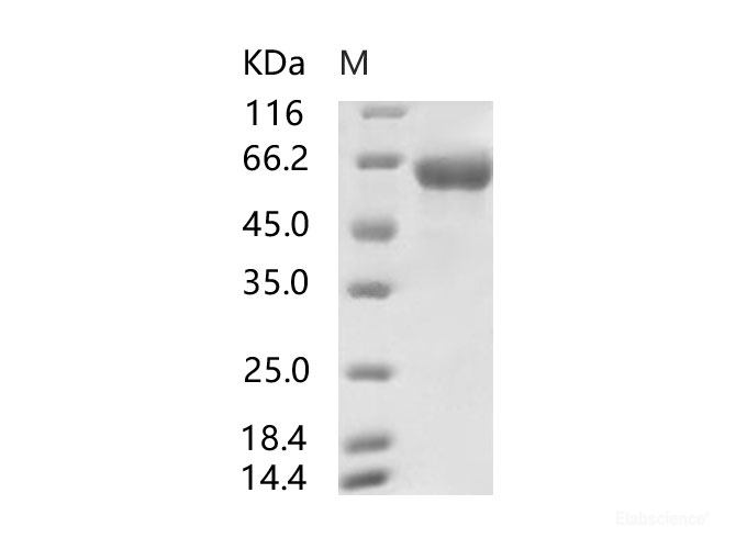 Recombinant SARS-CoV Spike S2-His Recombinant Protein