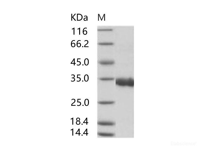 Recombinant SARS-CoV Spike/RBD Protein (RBD, His Tag)