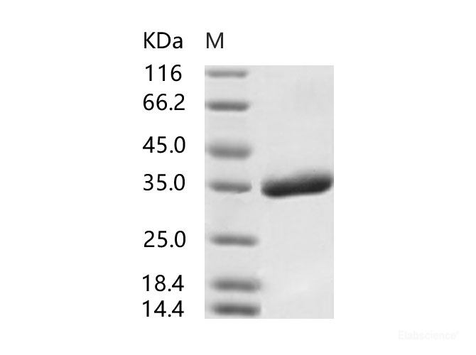 Recombinant SARS-CoV Spike/RBD Protein (RBD, His Tag), Biotinylated