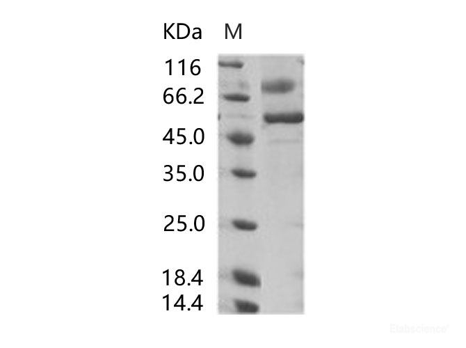 Recombinant SARS-CoV Spike/RBD Protein (RBD, rFc Tag)