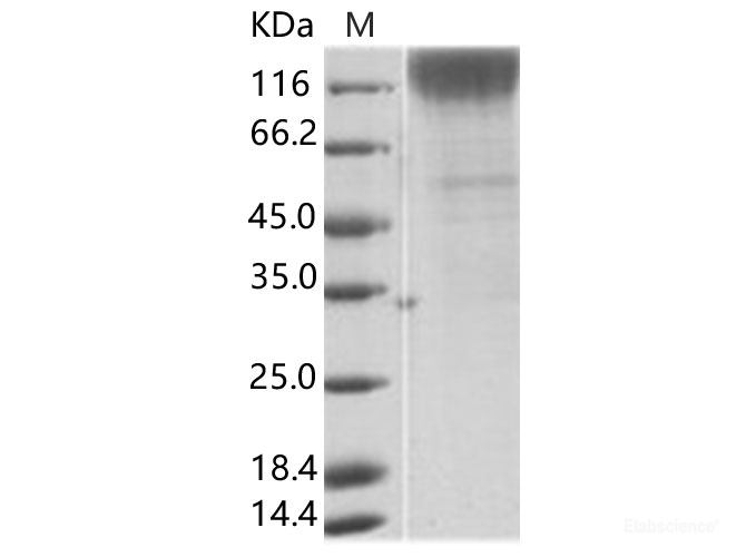 Recombinant SIV (isolate 216.94.A2) gp120 Protein (His Tag)
