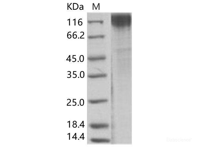 Recombinant SIV (isolate F236) envelope glycoprotein gp120 Protein (His Tag)