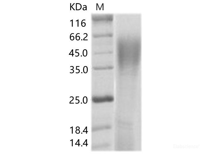 Recombinant SIV (isolate SIVmac251v31523ru28) envelope glycoprotein gp120 Protein (His Tag)