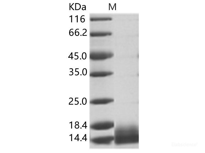 Recombinant WNV (lineage 1, strain NY99) E / Envelope Protein (Domain III, His Tag)