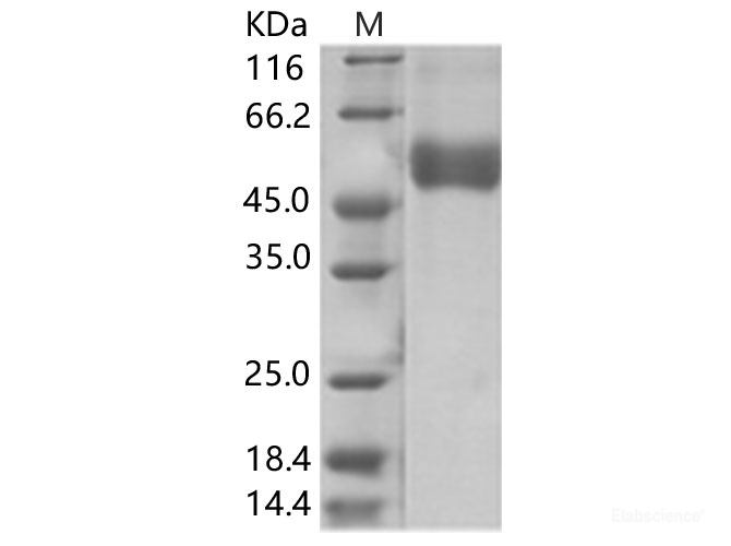 Recombinant WNV (lineage 1, strain NY99) NS1 Protein (His Tag)