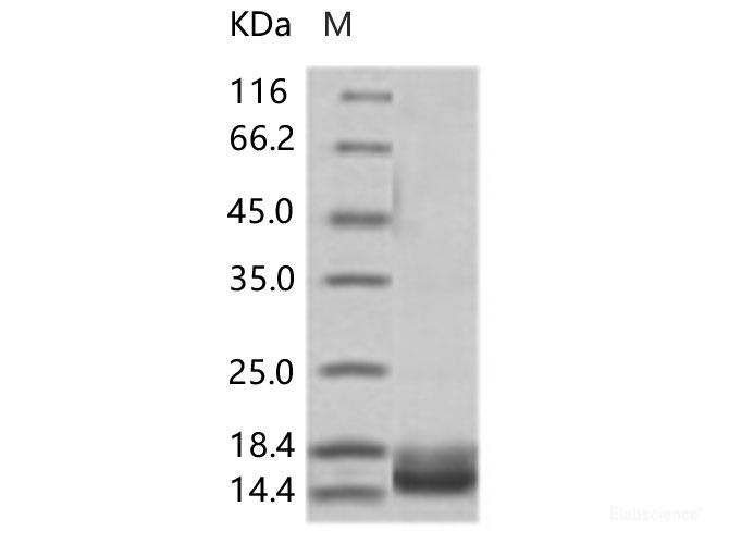 Recombinant WNV (lineage 2, strain Nea Santa-Greece-2010) E / Envelope Protein (Domain III, His Tag)