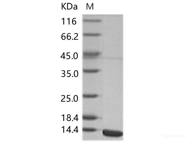 Recombinant WNV (lineage 2, strain Nea Santa-Greece-2010) E / Envelope Protein (Domain III, His Tag)