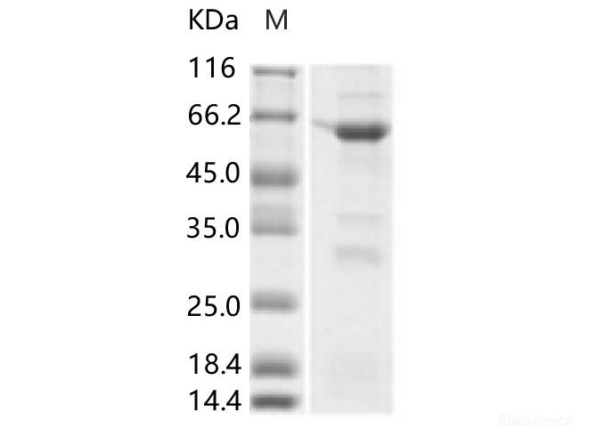 Recombinant ZIKV E / Envelope protein (Domain I, His & MBP Tag)
