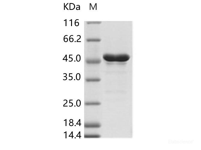 Recombinant ZIKV (strain Zika SPH2015) Envelope protein (aa 291-696, His Tag)