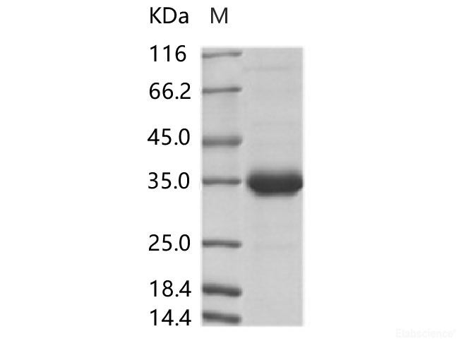 Recombinant ZIKV (strain Zika SPH2015) Membrane protein (Fc Tag)