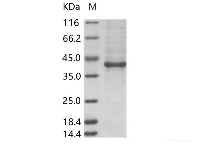Recombinant ZIKV (strain Zika SPH2015) Envelope protein (Domain III, Fc Tag)