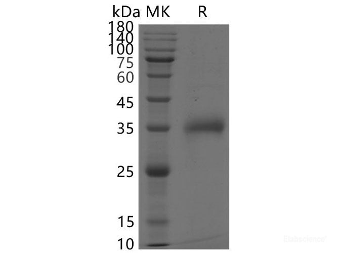 Recombinant SARS-CoV-2 Spike RBD(K417N,E484K,N501Y)(His Tag)