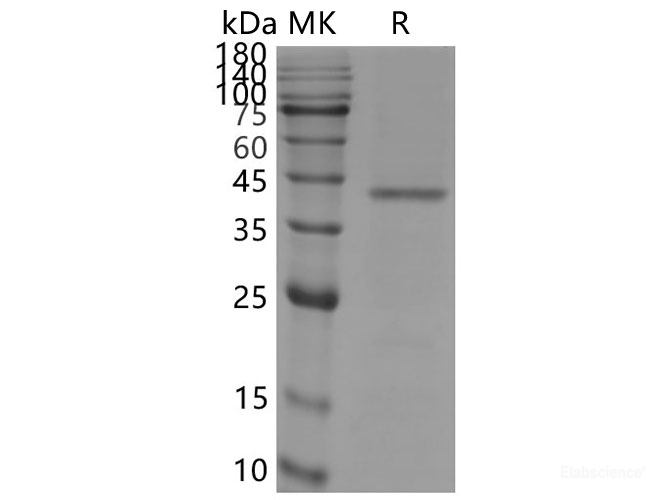 Recombinant SARS-CoV-2 S+E+M protein