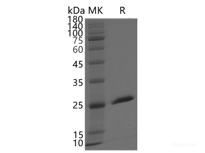 Recombinant SARS-CoV-2 NSP3 protein